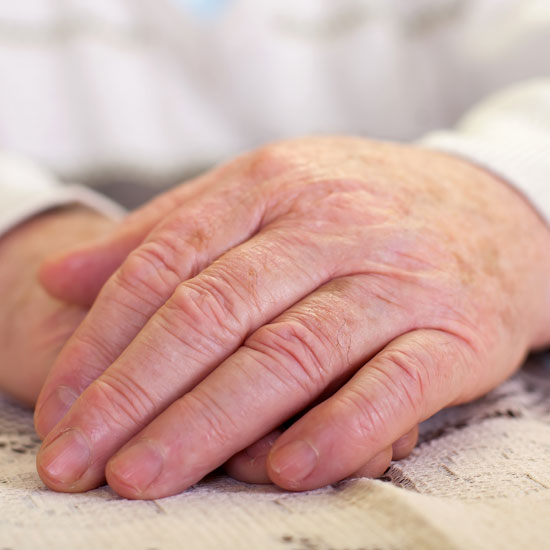 Mano Degenerativa Tratamiento de la mano degenerativa en la Unidad de Traumatología y Cirugía de mano y muñeca