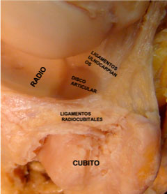 Lesión del Fibrocartílago Triangular Componentes del Ligamento Fibrocartílago Triangular