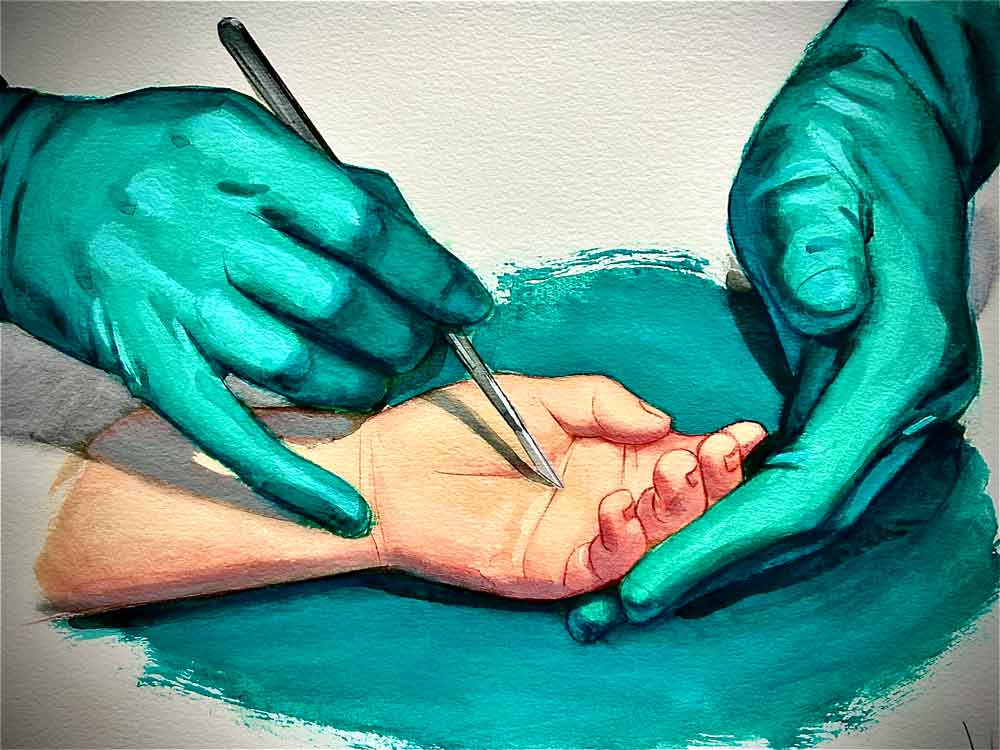 Artroscopia de Mano y Muñeca IMG 5332