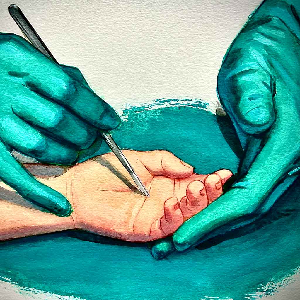 Mano Degenerativa Unidad de cirugía de la mano y muñeca de Madrid