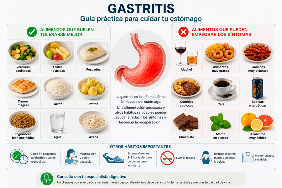 Guía visual con alimentos recomendados y alimentos que pueden empeorar los síntomas de la gastritis.
